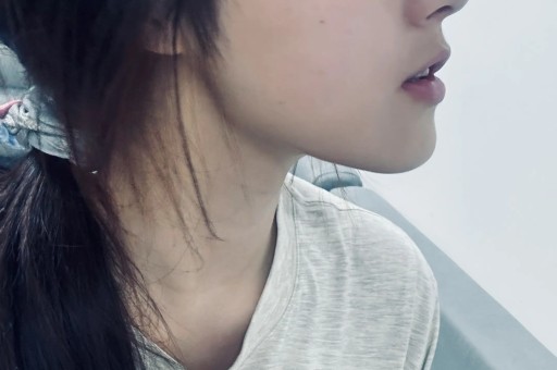 陈光标回应张雪捐赠自己送的豪车 网友持续吃瓜：律师称交付前可撤销赠与